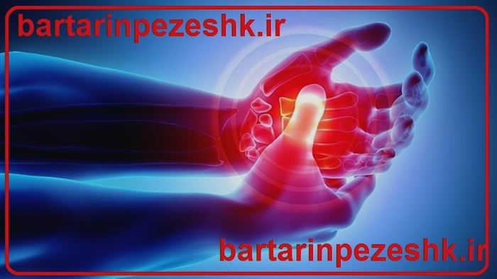  درمان آرتروز انگشت شست دست 