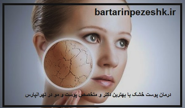 بهترین دکتر و متخصص پوست و مو در تهرانپارس