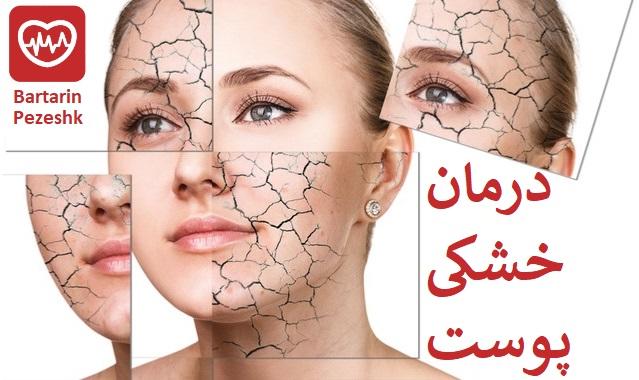 درمان پوست خشک با بهترین دکتر و متخصص پوست و مو در تهرانپارس