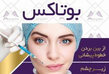 تزریق بوتاکس پیشانی در تهران