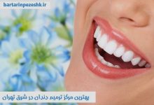 بهترین مرکز ترمیم دندان در شرق تهران