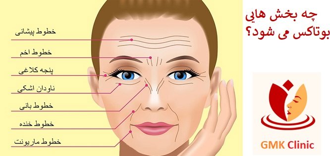 بوتاکس سعادت اباد
