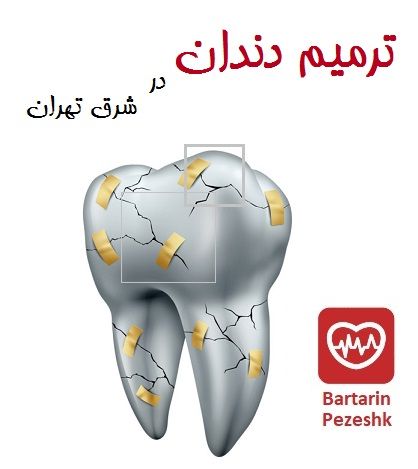 ترمیم دندان در شرق تهران