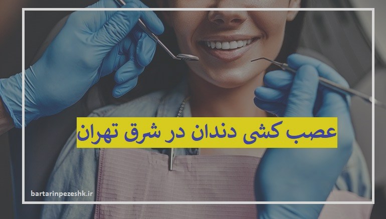 عصب کشی دندان ر شرق تهران