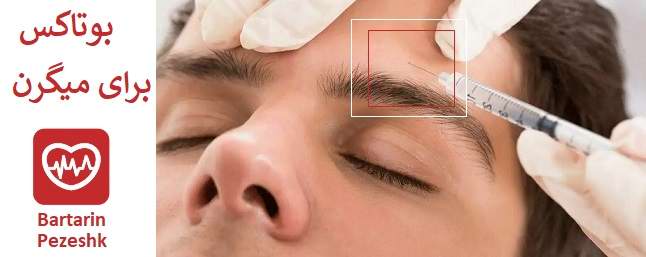 مزایای بوتاکس در گیشا