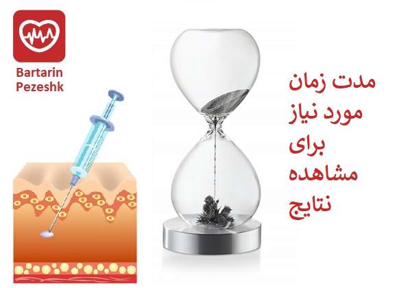 مدت زمان مورد نیاز برای مشاهده نتایج
