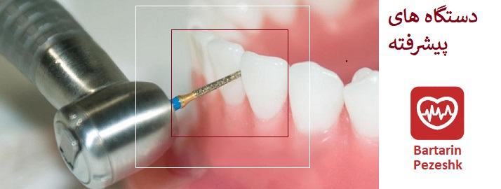 دستگاه های پیشرفته دندانپزشکی در پیروزی