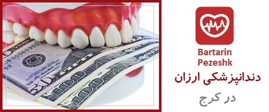 دندانپزشکی ارزان در کرج