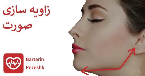 مزایای زاویه سازی با ژل