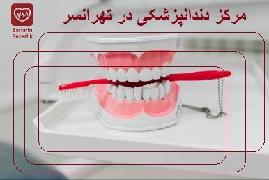 مرکز دندانپزشکی در تهرانسر