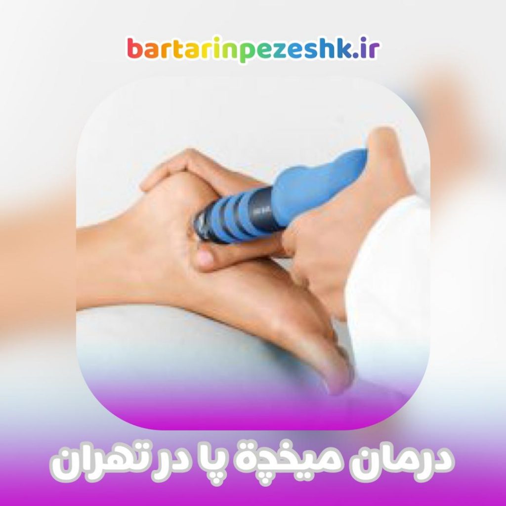 مراکز درمان میخچه پا در تهران