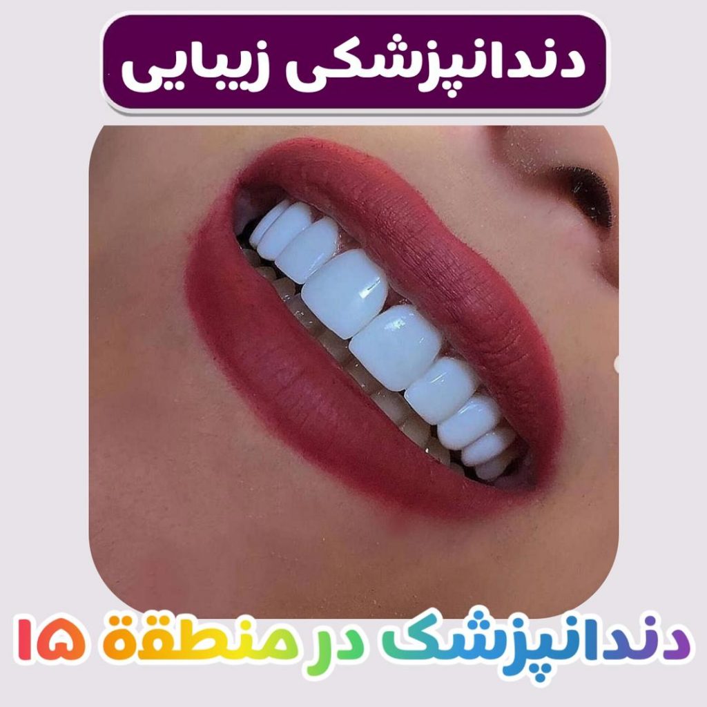 دندانپزشک خوب زیبایی منطقه 15 تهران شرق