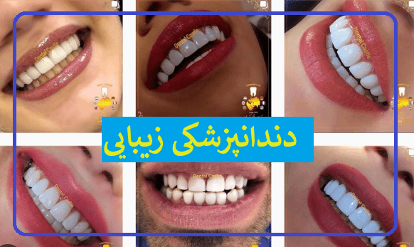 دندانپزشکی زیبایی در تهران