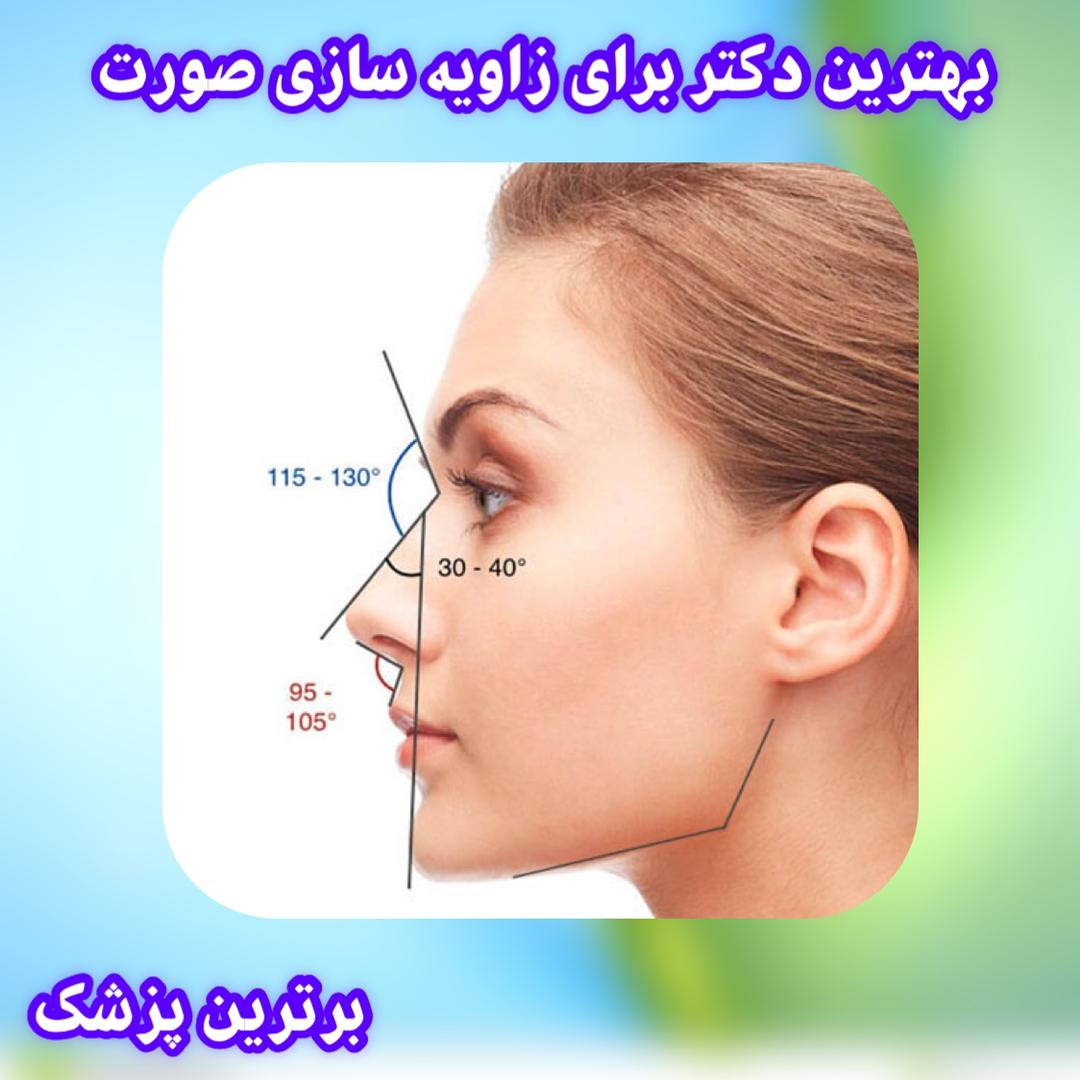 بهترین دکتر برای زاویه سازی صورت در تهران زاویه سازی صورت در سعادت آباد