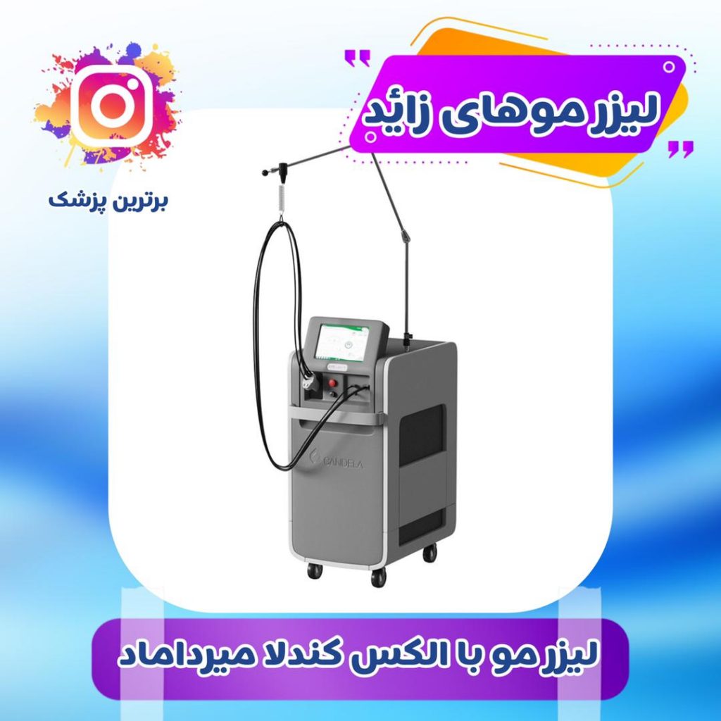لیزر موهای زائد در میرداماد