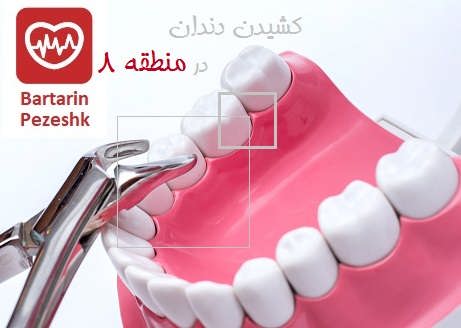 کشیدن دندان در منطقه 8