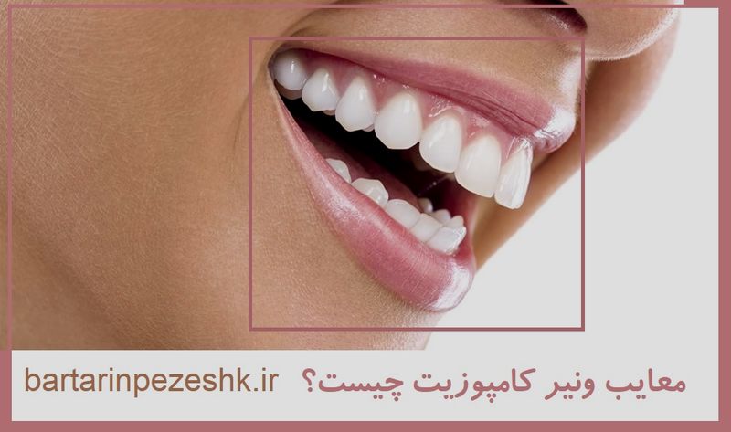 کلینیک کامپوزیت و لمینت دندان در نارمک