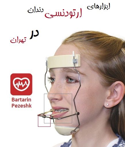 ابزار‌های‌ ارتودنسی دندان در تهران