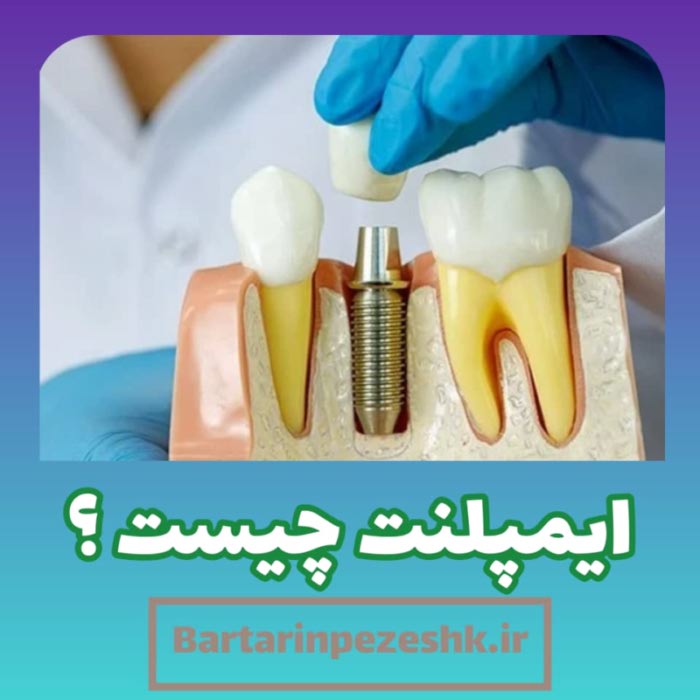 مرکز ایمپلنت دندان در نارمک