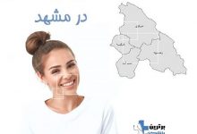 متخصص لمینت دندان در مشهد