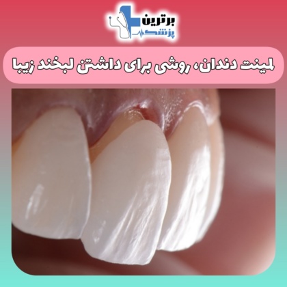 چگونگی سفیدکردن دندان ها