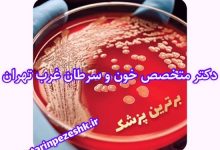 متخصص سرطان خون در غرب تهران
