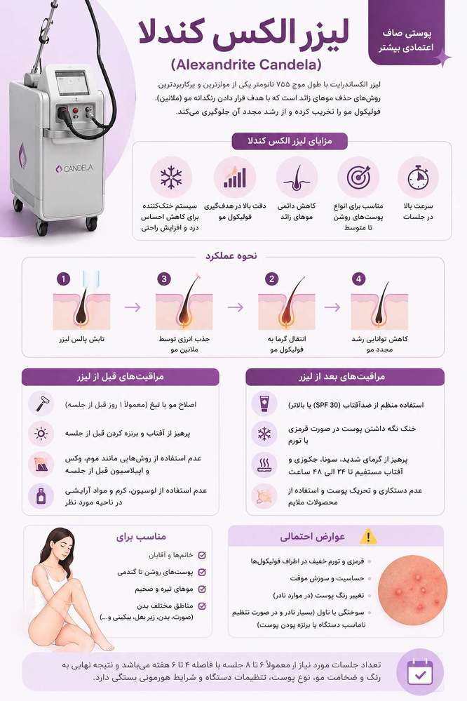 لیزر الکس کندلا