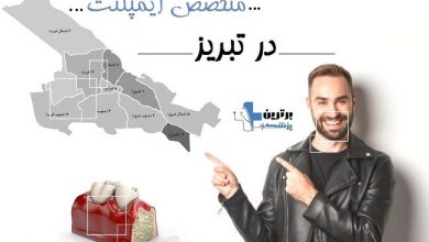 متخصص ایمپلنت در تبریز
