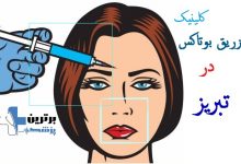 کلینیک تزریق بوتاکس در تبریز