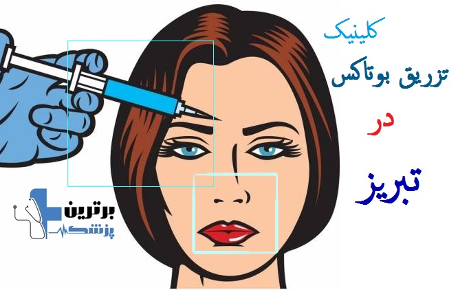 کلینیک تزریق بوتاکس در تبریز