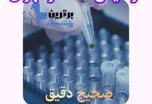 تست آزممایش hiv در تهران