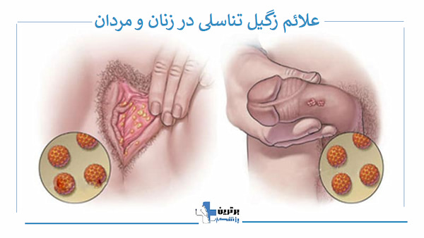 معرفی دکتر درمان زگیل تناسلی در بلوار فردوس