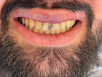 دندانپزشکی تاج آبادی