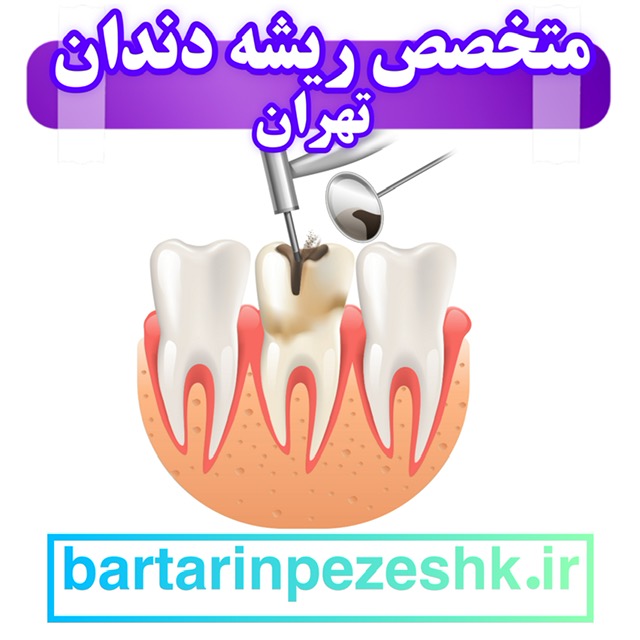 دکتر درمان ریشه دندان در تهران