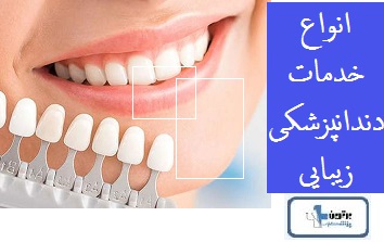 انواع خدمات دندانپزشکی زیبایی