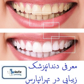 معرفی دندانپزشک زیبایی در تهرانپارس 