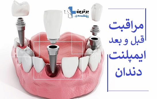 معرفی مطب ایمپلنت دندان در الهیه