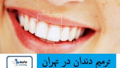 ترمیم دندان در تهران