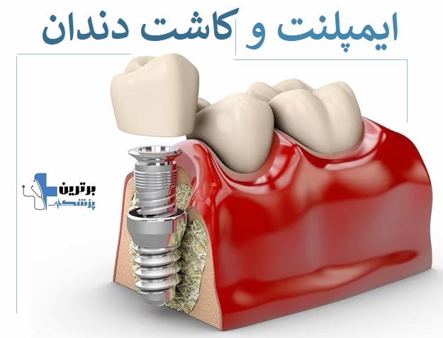دندانپزشکی در منطقه 10 تهران