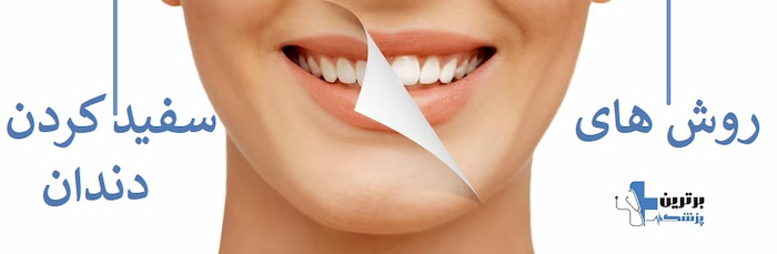 روش ها ی سفید کردن دندان
