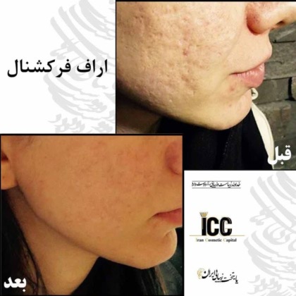 گروه پزشکان زیبایی پایتخت زیبایی ایران 