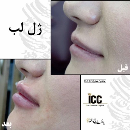 گروه پزشکان زیبایی پایتخت زیبایی ایران 
