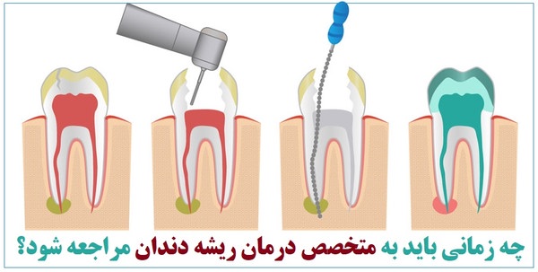 درمان ریشه دندان در سعادت آباد