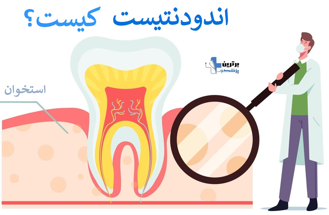 بهترین متخصص درمان ریشه دندان در سعادت آباد کیست؟
