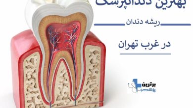 بهترین دندانپزشک درمان ریشه دندان در غرب تهران کیست؟