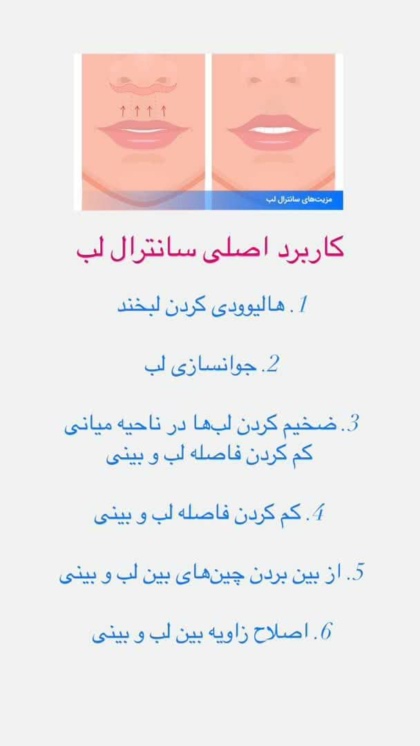 بهترین جراح لیفت سانترال لب در تهران