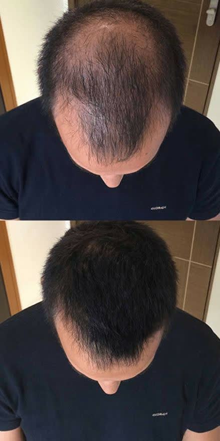 نمونه کار پی آر پی مو مرکز زیبایی ندا