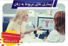بیماری های مربوط به زنان