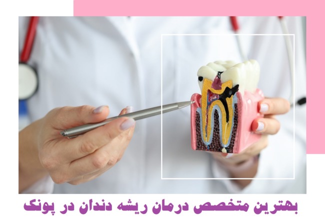 متخصص درمان ریشه دندان در پونک