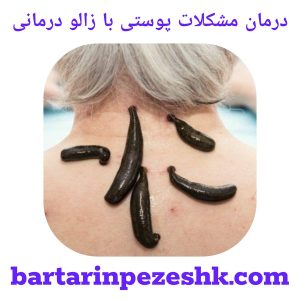 درمان مشکلات پوستی با زالو درمانی
